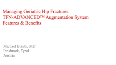 An image from the "Managing Geriatric Hip Fractures: TFNA System Review with Michael Blauth, MD" video on the JnJInstitute.com website.