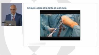 An Image From "Managing Geriatric Hip Fractures: TFNA Surgical Technique - Michael Blauth, MD"