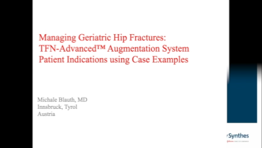 An image from the "Managing Geriatric Hip Fractures Case Review with Michael Blauth, MD" video on the JnJInstitute.com website.