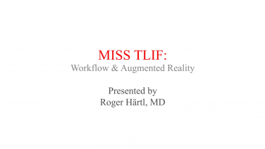 An image from the "Microlearning MISS TLIF - Navigated Workflow & Augmented Reality" video on the JnJInstitute.com website.