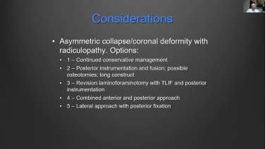 An image from the "MIS Approach - Lateral Case Analysis with Joshua Abrams, DO" video on the JnJInstitute.com website.