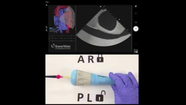 ICE Catheter Manipulation