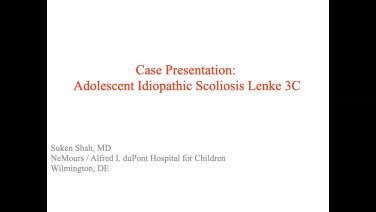 an image from "Case Presentation: Adolescent Idiopathic Scoliosis Lenke 3C with Suken Shah, MD" video on jnjinstitute.com website