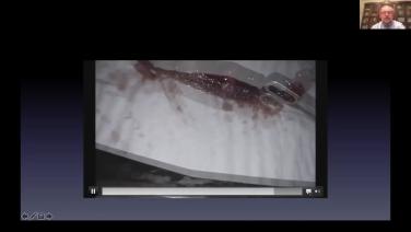 An Image From "Managing Challenging VATS Cases: The How & Why - Webinar"