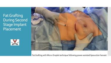 Otimizando Resultados de Segurança e Estéticos para Reconstrução Baseada em Implantes Coordenação de segundo estágio e avaliação de resultados Header Image