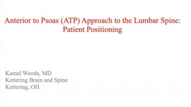 image from "Anterior to Psoas (ATP) Approach to the Lumbar Spine: Patient Positioning with Kamal Woods, MD " video on jnjinstitute.com