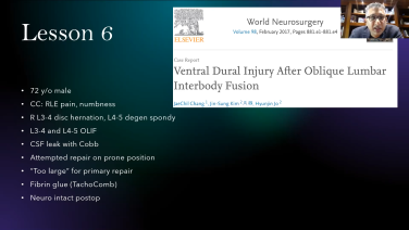 An image from the "Understanding Anatomy Pitfalls - Case Studies with Kamal Woods, MD" video on the JnJInstitute.com website.
