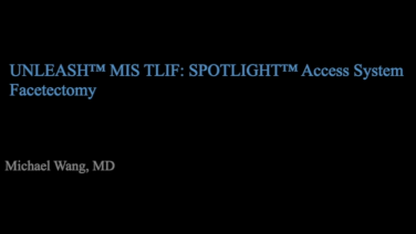 An image from the "UNLEASH MIS TLIF Procedural Solution - Facetectomy with Michael Wang, MD" video on the JnJinstitute.com website.