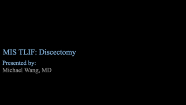 An image from the "UNLEASH MIS TLIF Procedural Solution - Discectomy with Michael Wang, MD" video on the JnJInstitue.com website.