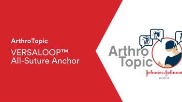 An image from the "ArthroTopic Webinar: VERSALOOP™ All-Suture Anchor" video on the JnJInstitute.com website.