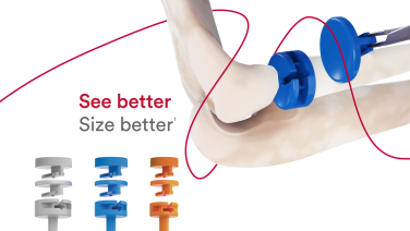 An image from the "Radial Head Fractures: The Approach with Jeff Shulman, MD" video on the JnJInstitute.com website.