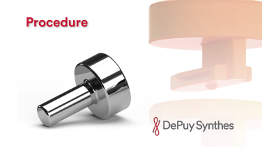 An image from the "Radial Head Fractures: Incision & Exposure with Jeff Shulman, MD' video on the JnJInstitute.com website.