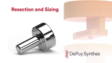 An image from the "Radial Head Fractures: Bone Resection & Implant Sizing with Jeff Shulman, MD" video on the JnJInstitute.com website.