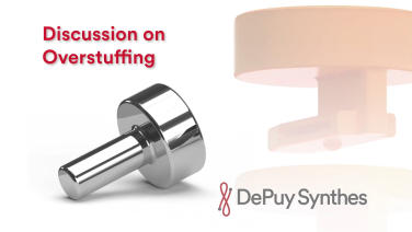 An image from the "Radial Head Fractures: Overstuffing with Jeff Shulman, MD" video on the JnJInstitute.com website.