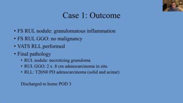 An Image From "Tips and Techniques for Managing Challenging Video Assisted Thoracic Surgery"