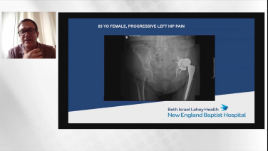 An image from the "Anterior Approach: Revision THA Acetabular Defects: Classification & Case Study with Charles DeCook, MD" video on the JnJInstitute.com website.