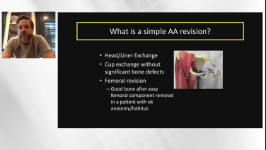 An image from the "Anterior Approach Revision THA: Anatomy Review & Considerations with Joseph Gondusky, MD" video on the JnJInstitute.com website.