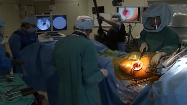 image of Anterior Approach THA: Femoral Preparation with Joel Matta, MD video on jnjinstitute.com
