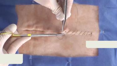 image of "Simple Continuous Suture Technique" video on jnjinstitute.com