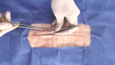 image of "Horizontal Mattress Suture Technique" video on jnjinstitute.com