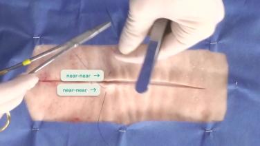 image of "Vertical Mattress Suture Technique" video on jnjinstitute.com