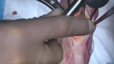 image of Management of Foot & Ankle Deformities Master Class with Matt Hope, MD- Part 3