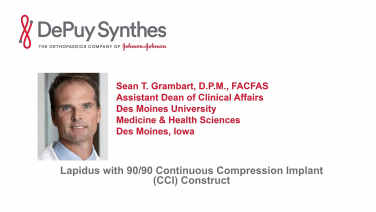 An image from the "Lapidus Arthrodesis Using 90/90 Continuous Compression Implants with Sean Grambart, DPM" video on the JnJInstitute.com website.