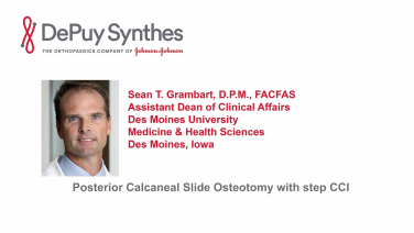 An image from the "Posterior Calcaneal Slide Osteotomy with Sean Grambart, DPM" video on the JnJInstitute.com website.