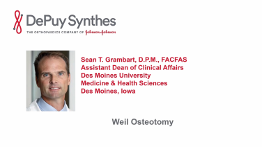 An image from the "Weil Osteotomy with Sean Grambart, DPM" video on the JnJInstitute.com website.