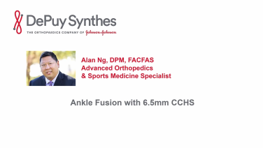 An image from the "Anterior Approach Ankle Arthrodesis with Alan Ng, DPM" video on the JnJInstitute.com website.