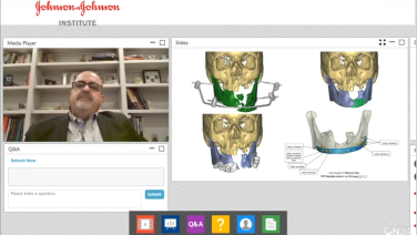 An image from the "Midface Trauma Fractures: GSW Case Reviews with Nagi Demian, MD" video on the JnJInstitute.com website.