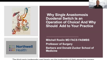 An Image From "Effectiveness of Single Anastomosis Duodenal Switch (SADI-S) Procedures with Mitchell Roslin, MD"