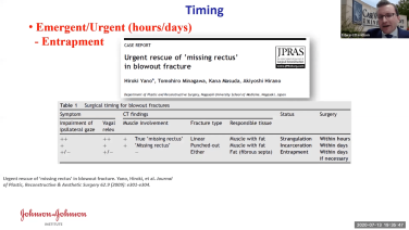An image from the "Concepts in Orbital Reconstruction: Timing with Edward Davidson, MD" video on the JnJInstitute.com website.