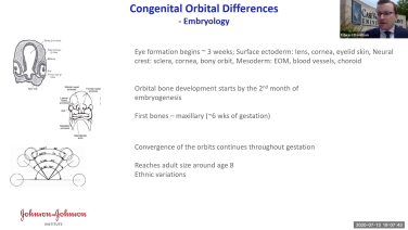 An image from the "Concepts in Orbital Reconstruction: Congenital Orbital Differences with Edward Davidson, MD" video on the JnJInstitute.com website.