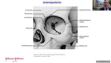 An image from the "Concepts in Orbital Reconstruction: Anatomy with Edward Davidson, MD" video on the JnJInstitute.com website.