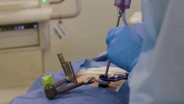 An image from the "TELIGEN™ Clear Discectomy Device with Ross Jones, D.O." video on the JnJInstitute.com website.