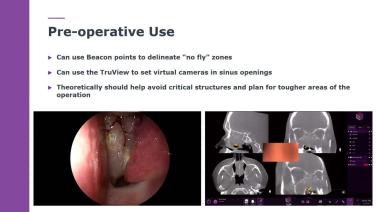 An Image From "TruDi in Complex Cases with Zachary Cappello, MD"