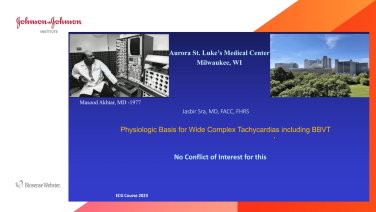 An Image from "ECG and Intracardiac Recordings to Diagnose and Ablate Bundle or Interfascicular VT with Jasbir Sra, MD"