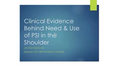 Clinical Evidence Behind the Need & Use of PSI in the Shoulder with Stueve, MD thumbnail image