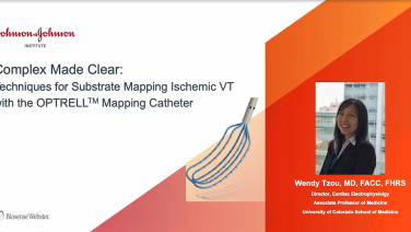 An Image From "Techniques for Substrate Mapping Ischemic VT with the OPTRELL Mapping Catheter"