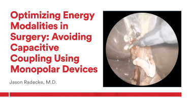 An Image From "Optimizing Energy Modalities in Surgery: Using Ultrasonic Devices with Jason Radecke, MD"
