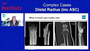 Image from Managing Complex Distal Radius Fractures - Aaron Daluiski, MD & Amy Speeckaert, MD