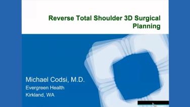 Reverse Total Shoulder 3d Surgical Planning with Codsi, MD