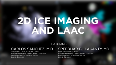 2D ICE Imaging for the Left Atrial Appendage Closure with Sreedhar Billakanty, MD and Carlos Sanchez, MD Header Image
