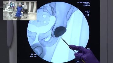 ANTERIOR ADVANTAGE™ Total Hip Arthroplasty with Hana® Table Tips & Pearls with Joseph Schwab, MD