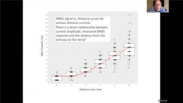 slide with a graph from "SENTIO: Understanding Nerve Status with Stephen Bartol, MD"