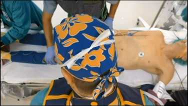 overhead view of Patient Positioning from "Minimally Invasive Lateral Lumbar Interbody Fusion with Puya Alikhani, MD"