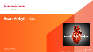 An image from the "Heart Arrhythmias" on JnJInstitute.com website