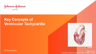 An image from the "Key Concepts of Ventricular Tachycardia" on JnJInstitute.com website