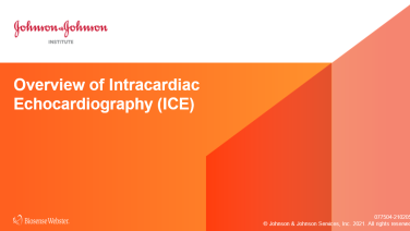 An image from the "Overview of IntraCardiac Echo" on JnJInstitute.com website